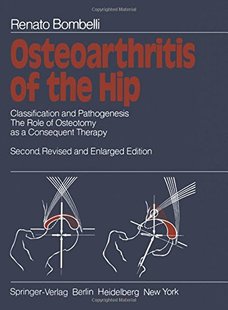 【预订】Osteoarthritis of the Hip: Classific...