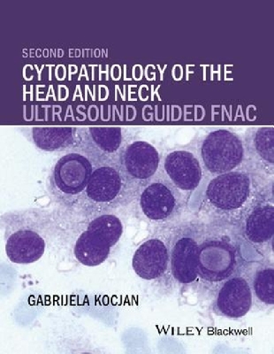 【预订】Cytopathology of the Head and Neck