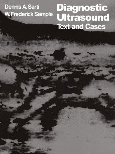 美国库房发货,通常付款后5-8周到货！