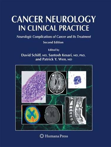 【预订】Cancer Neurology in Clinical Practic...