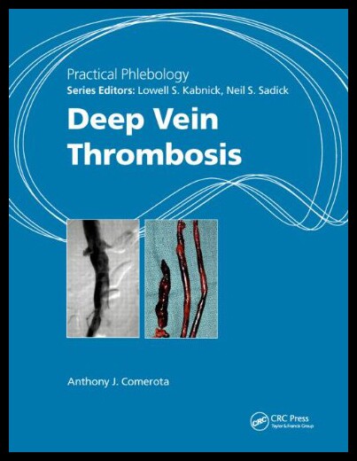 【预售】Deep Vein Thrombosis