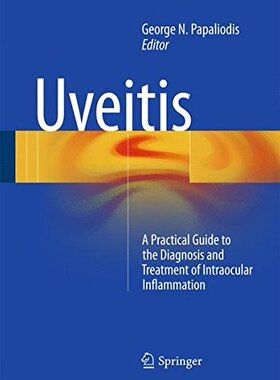 【预订】Uveitis