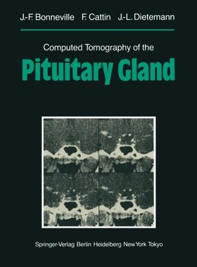 【预订】Computed Tomography of the Pituitary...
