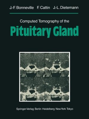 【预订】Computed Tomography of the Pituitary...