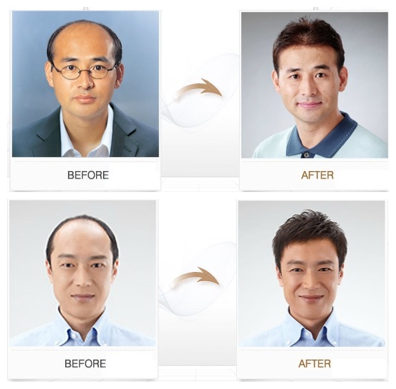 Extension cheveux - Ref 216851 Image 1