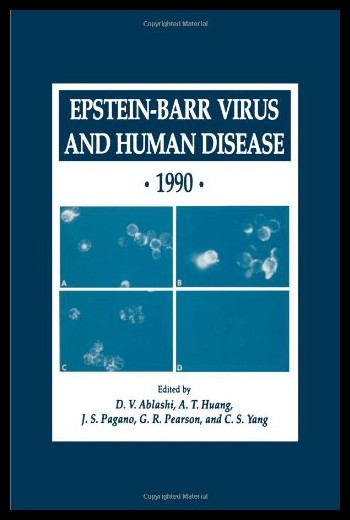 【预售】epstein-barr virus and human disease . 1990