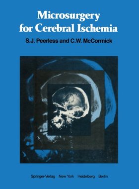 【预售】Microsurgery for Cerebral Ischemia