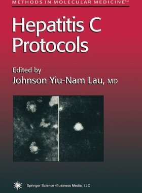【预订】Hepatitis C Protocols