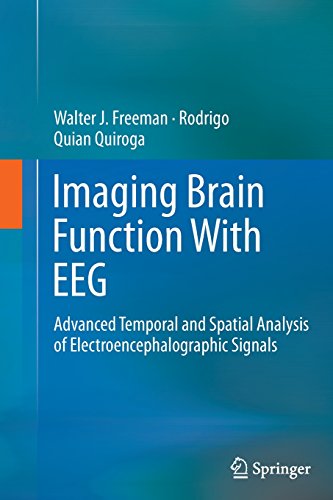 【预订】Imaging Brain Function With EEG
