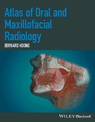 【预订】Atlas of Oral and Maxillofacial Radi...