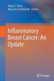 预订 Inflammatory Cancer Update Breast