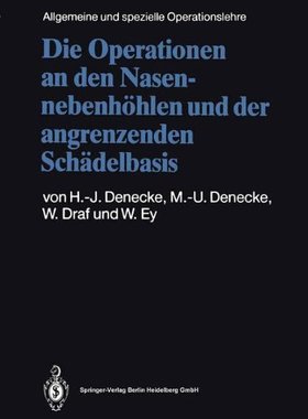【预订】Die Operationen an Den Nasennebenhoh...