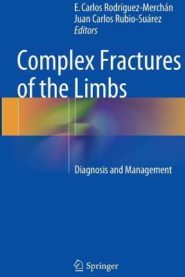 【预订】Complex Fractures of the Limbs: Diag...