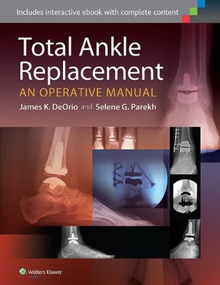 【预售】Total Ankle Replacement: An Operative Manual