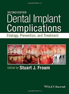 【预订】Dental Implant Complications