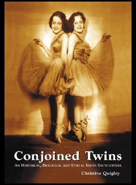 【预售】Conjoined Twins: An Historical, Biological and Et