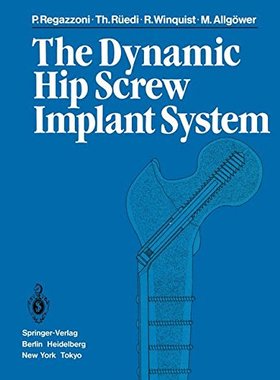 【预订】The Dynamic Hip Screw Implant System