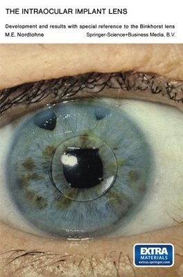 【预订】The Intraocular Implant Lens Develop...