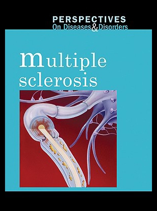 美国库房发货，通常付款后5-8周到货！