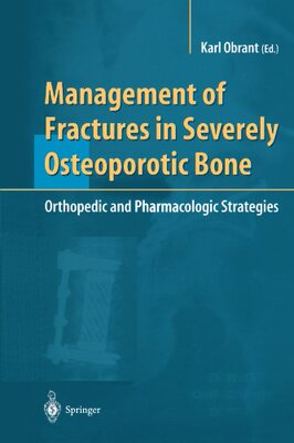 【预订】Management of Fractures in Severely ...