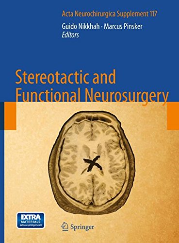 【预订】Stereotactic and Functional Neurosurgery