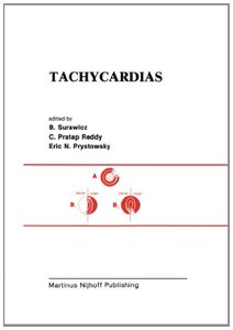 【预售】Tachycardias