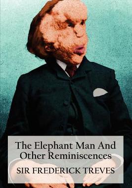 【预售】The Elephant Man and Other Reminiscences