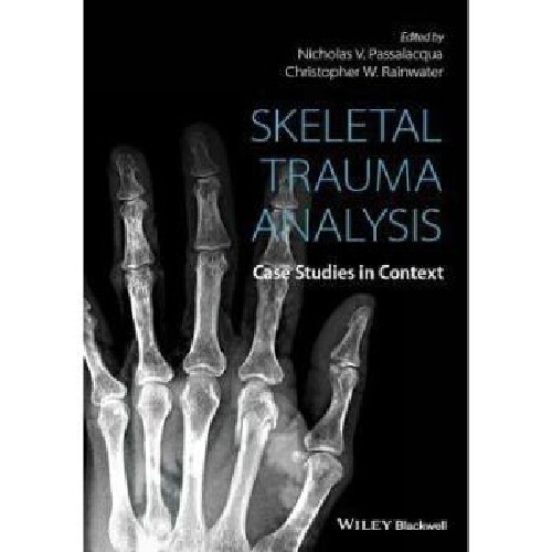 【预订】Skeletal Trauma Analysis - Case Stud...