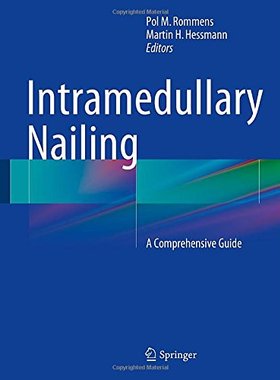 【预订】Intramedullary Nailing