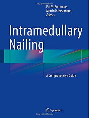 【预订】Intramedullary Nailing