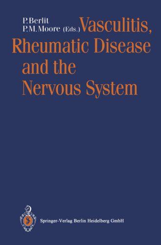 【预订】Vasculitis, Rheumatic Disease and th...