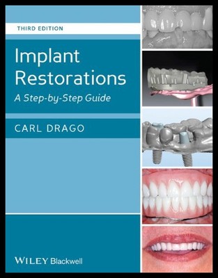 【预售】Implant Restorations: A Step-By-Step Guide