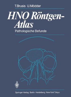 【预订】Hno Rontgen-Atlas: Pathologische Befunde