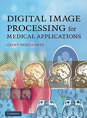 【预售】Digital Image Processing for Medical Applicatio