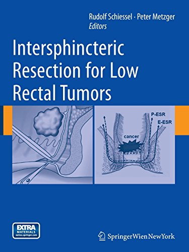 【预订】Intersphincteric Resection for Low R...