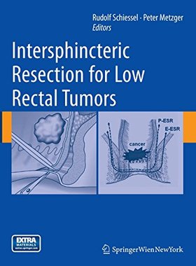 【预订】Intersphincteric Resection for Low R...