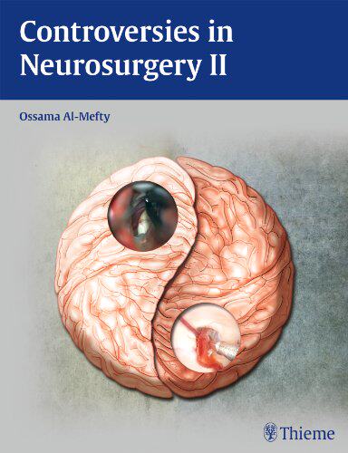 【预售】Controversies in Neurosurgery II