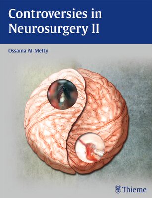 【预售】Controversies in Neurosurgery II