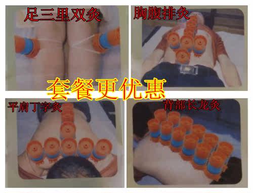 包邮灸灸康多功能艾灸器