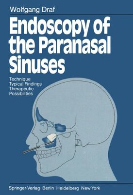 【预订】Endoscopy of the Paranasal Sinuses: ...