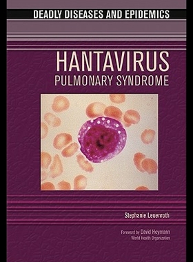 【预售】Hantavirus Pulmonary Syndrome