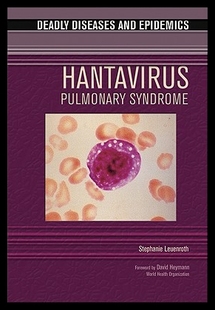 【预售】Hantavirus Pulmonary Syndrome
