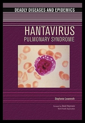 【预售】Hantavirus Pulmonary Syndrome