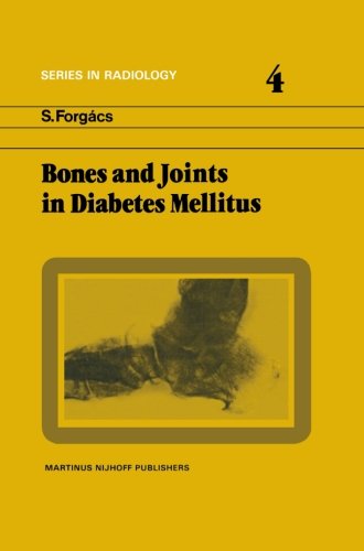 【预订】Bones and Joints in Diabetes Mellitus