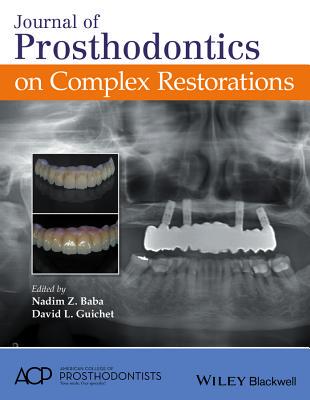 【预订】Journal of Prosthodontics on Complex...