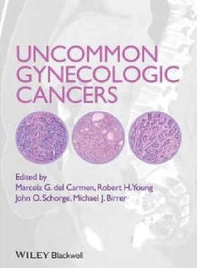 【预订】Uncommon Gynecologic Cancers