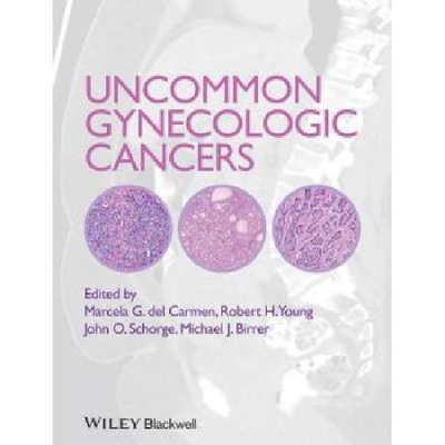 【预订】Uncommon Gynecologic Cancers