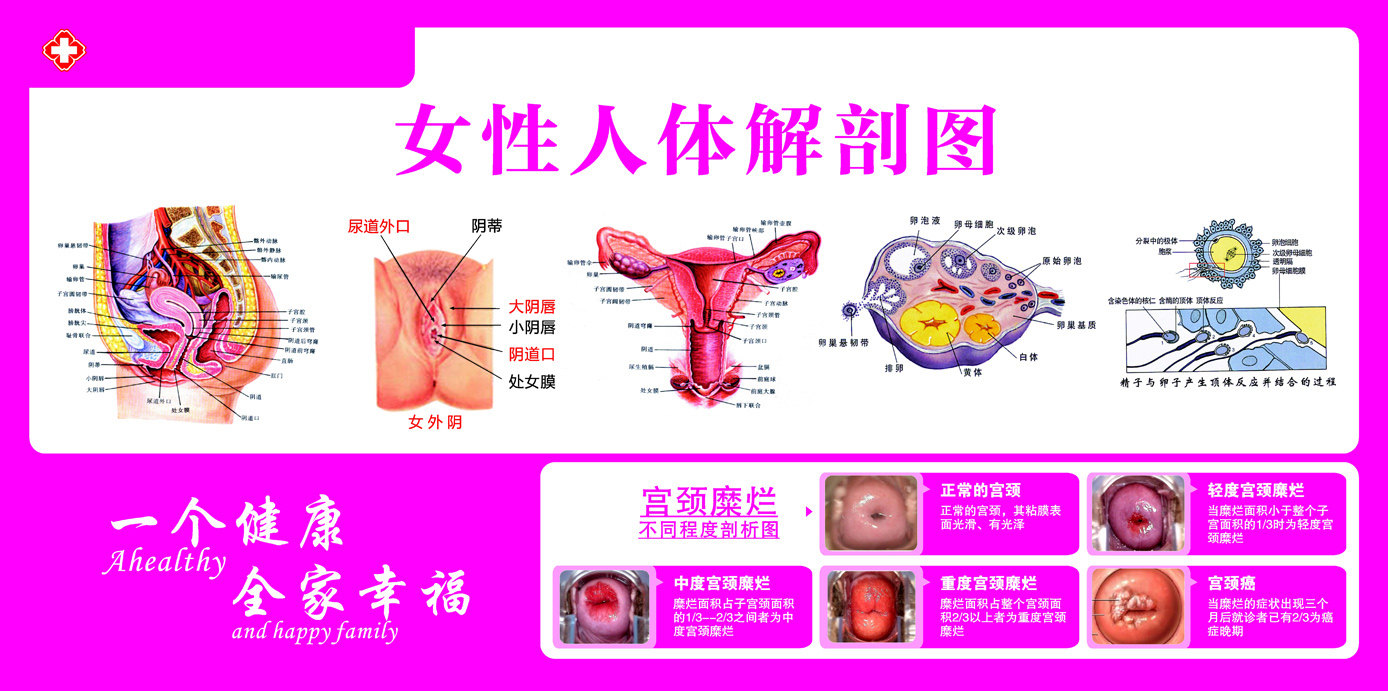 海报印制展板338素材9女性人体解剖图及宫颈不同程度剖析图