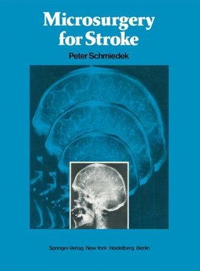 【预售】Microsurgery for Stroke