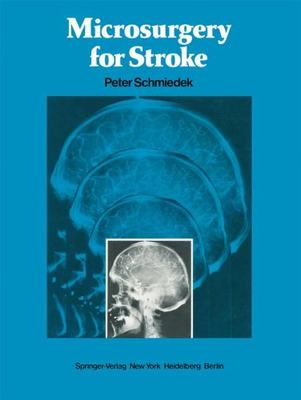 【预售】Microsurgery for Stroke